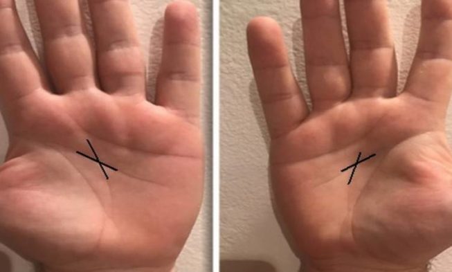 A rejtélyes “X” a tenyéren – Az emberek csupán 3 százalékánál jelenik meg img