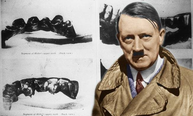 Megvizsgálták Hitler fogait – Az eredmények cáfolják az összeesküvés-elméleteket img